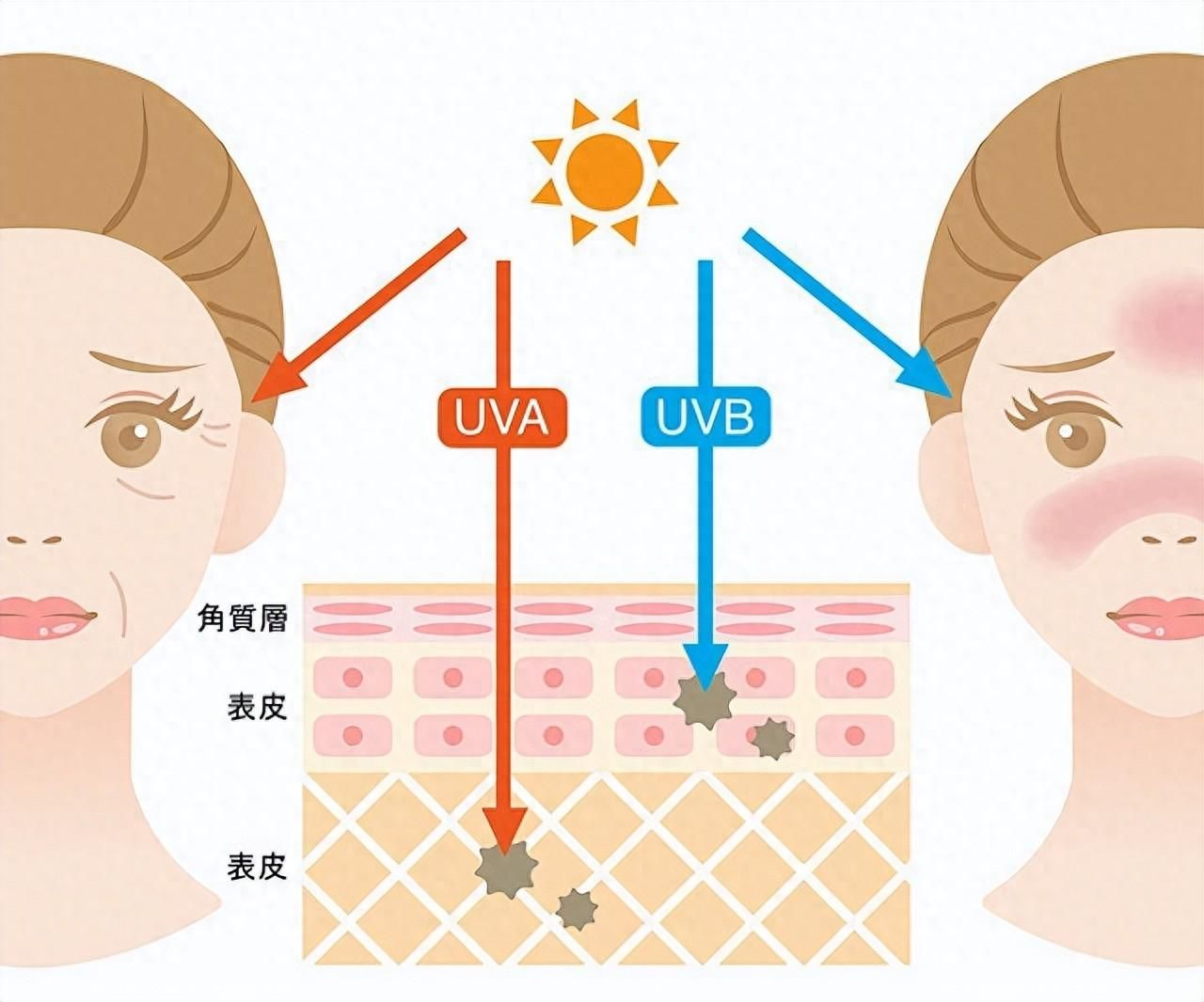 不看后悔！冬天豹纹 春季保养 - 豹纹妈妈产品怎么样